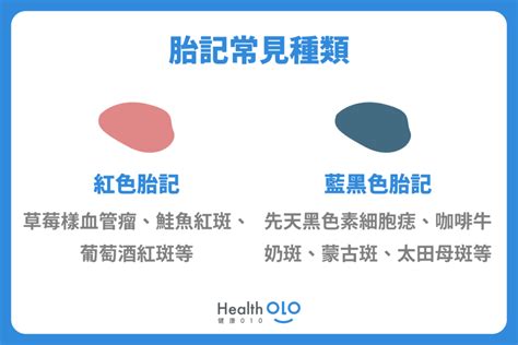 胎記手臂|胎記怎麼產生、何時消除？醫師剖析胎記種類、胎記寓意